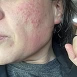 Customer Image, click to open customer review