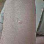 Customer Image, click to open customer review