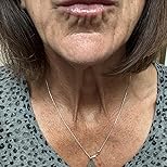 Customer Image, click to open customer review